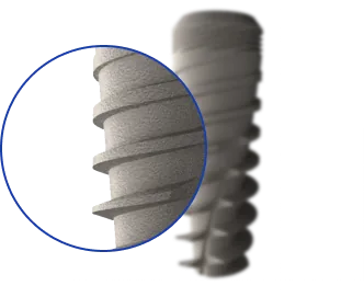 Optimized Thread — i-Fix implant design
