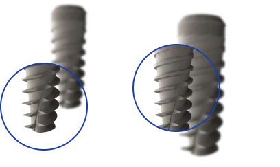 Anatomical Taper — i-Fix implant design
